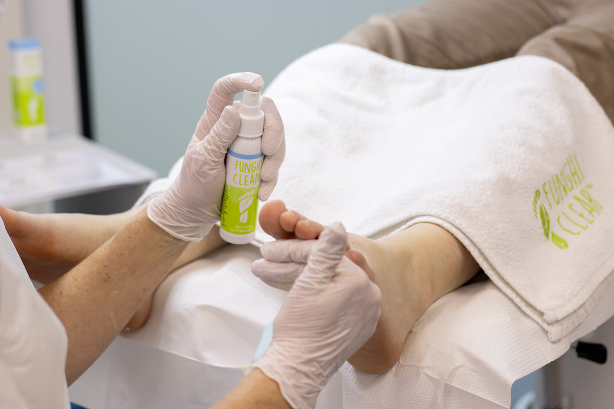 Voetverzorgingsspecialist brengt FunghiClear® nagelspray aan om teennagelschimmel te behandelen tijdens een consult.